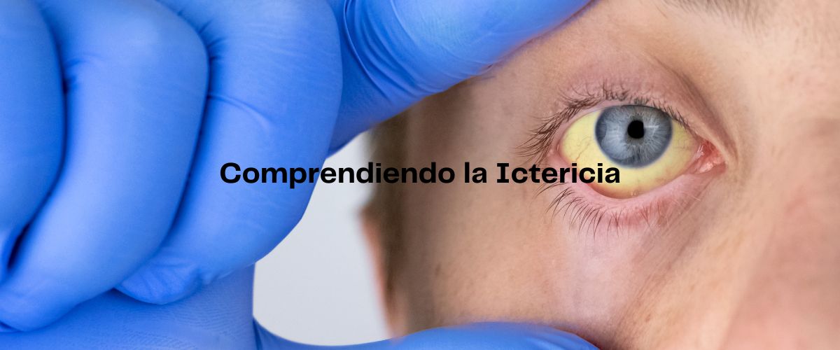 Comprendiendo la Ictericia: Causas, Síntomas, Diagnóstico y Tratamiento