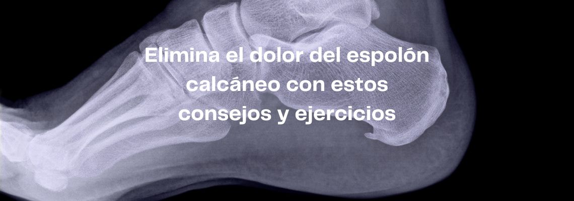 Elimina el dolor del espolón calcáneo con estos consejos y ejercicios