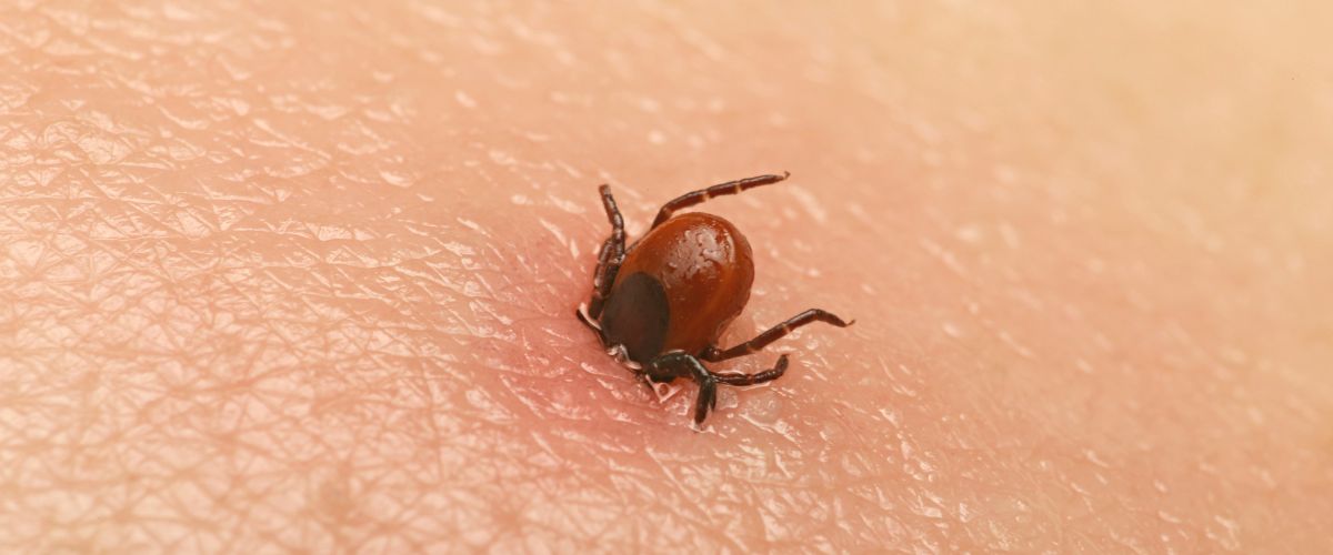 Fiebre Manchada de las Montañas Rocosas (FMMR): Un Análisis Detallado
