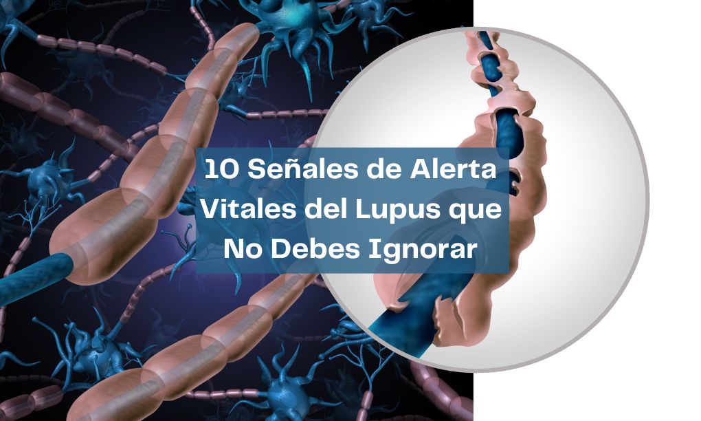 10 Señales de Alerta Vitales del Lupus que No Debes Ignorar