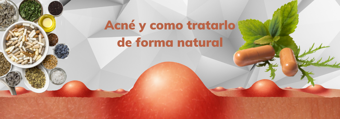 Qué es el acné y cómo tratarlo con suplementos naturales?
