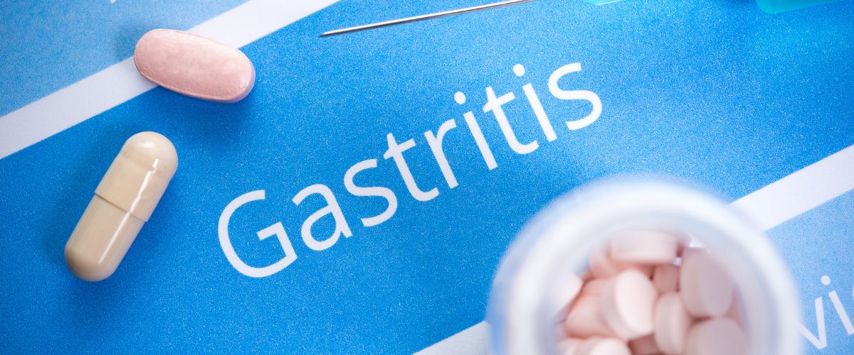 Todo Sobre la Gastritis Crónica: Causas, Síntomas y Tratamientos Eficaces