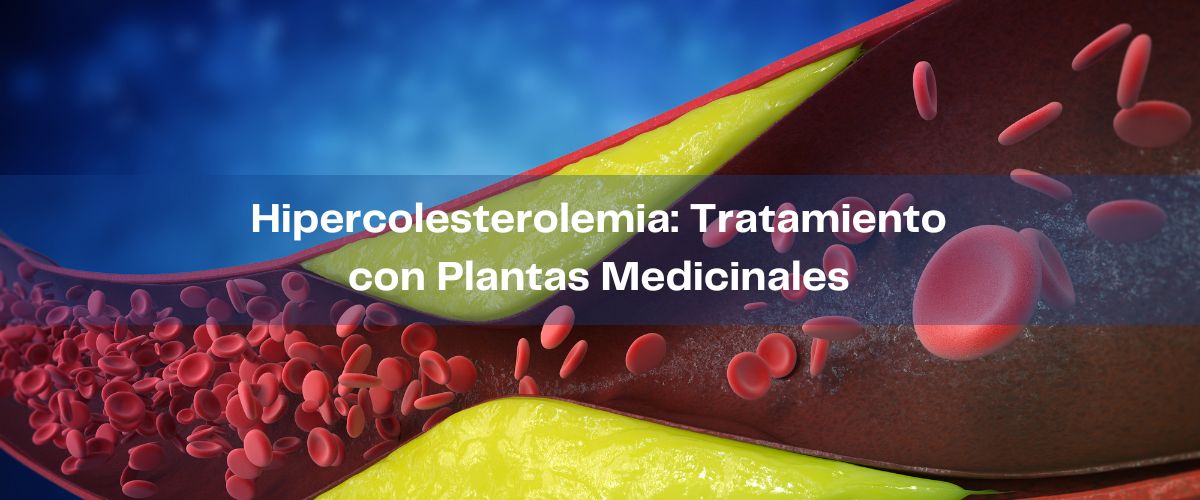 Hipercolesterolemia: Conocimientos Esenciales y Tratamiento con Plantas Medicinales