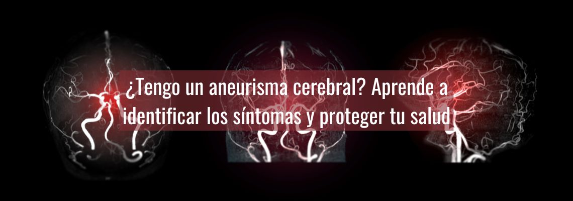 Aneurisma cerebral en Casitodoonline