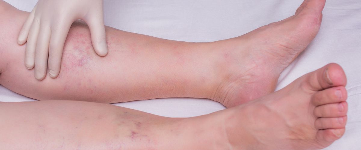 Mejora la Circulación de Tus Piernas Aunque Estés Sentado: Una Rutina de Ejercicios Fácil y Efectiva