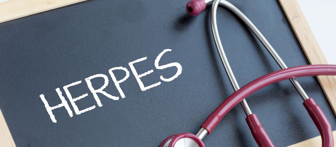 Información del herpes en Casitodoonline