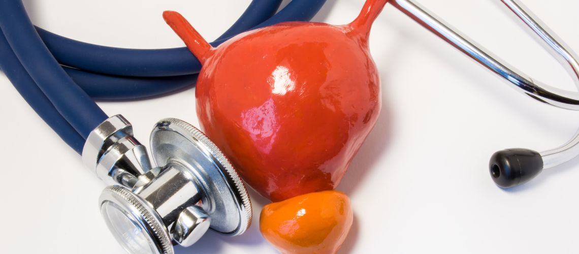 Hiperplasia prostática en Casitodoonline