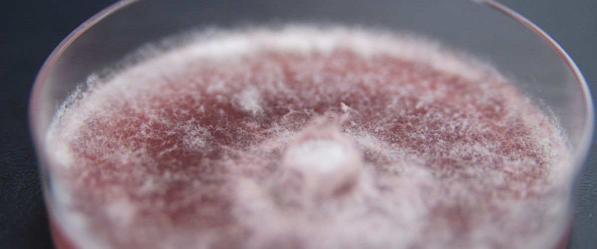 Información del Fusarium Solani en Humanos en Casitodoonline