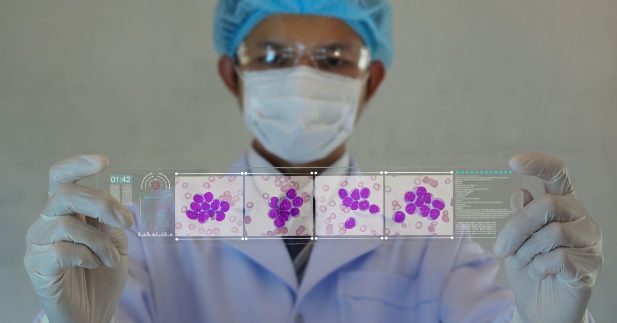 Leucemia: Conoce sus Síntomas, Factores de Riesgo y Tratamiento