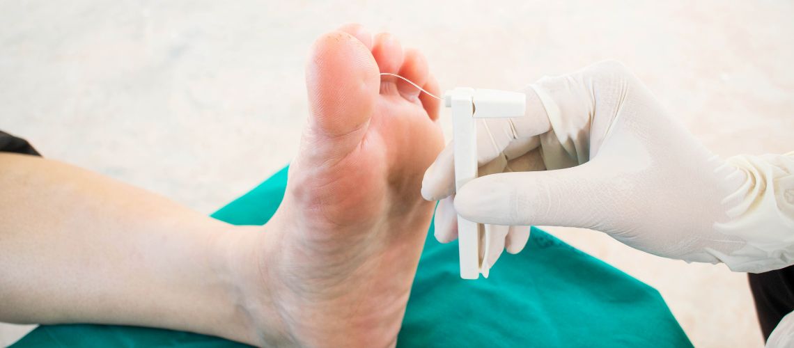 Cómo Superar la Neuropatía Utilizando Poderosas Hierbas Medicinales