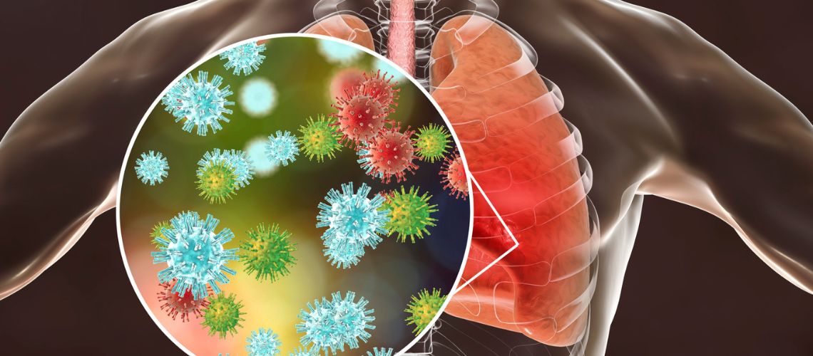 Virus sincitial en México
