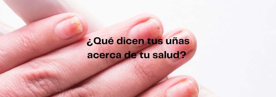 ¿Qué dicen tus uñas acerca de tu salud? Descúbrelo aquí